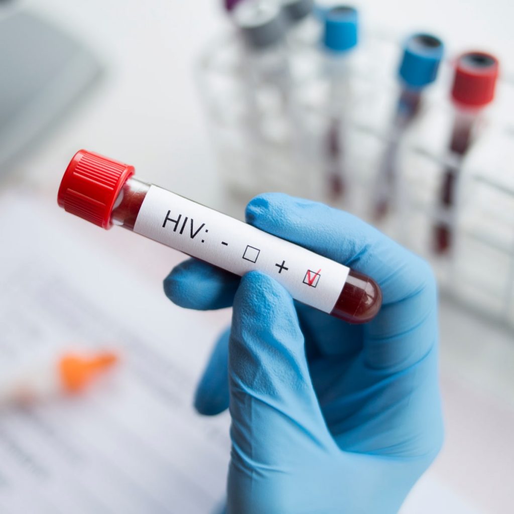 hiv test kit singapore