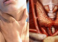 Cure For Thyroid Symptoms